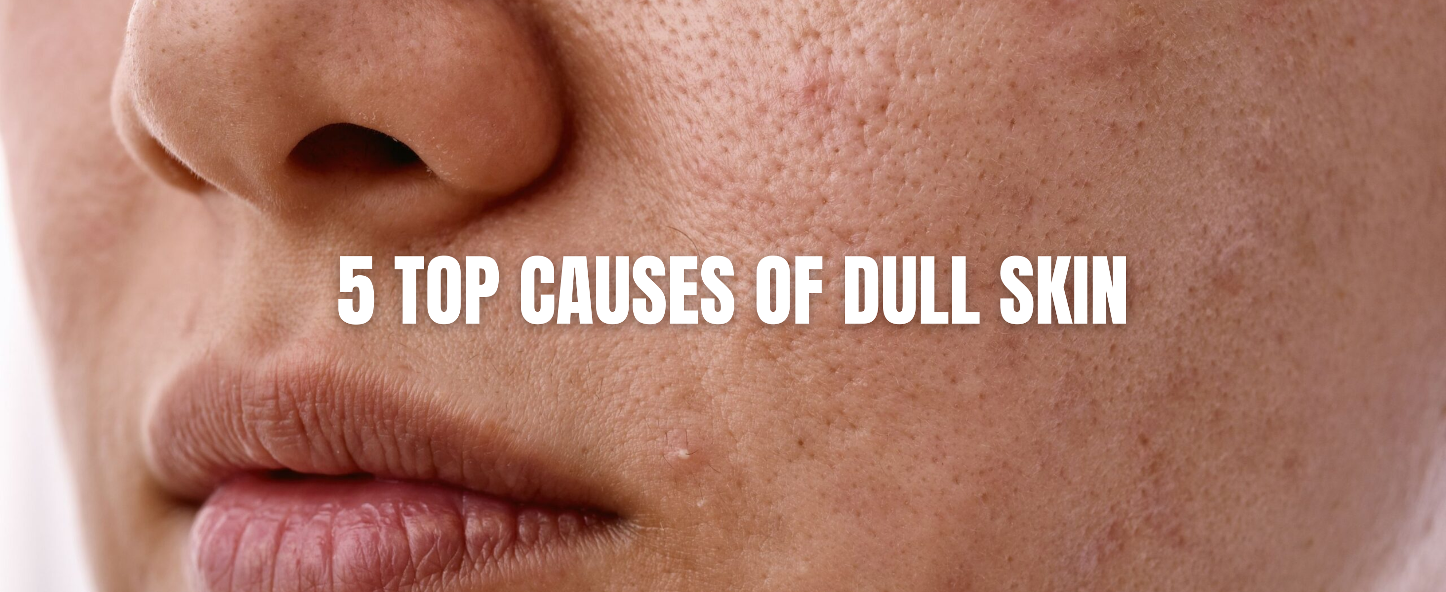 5 Top Causes of Dull Skin | How to Revive Your Glow