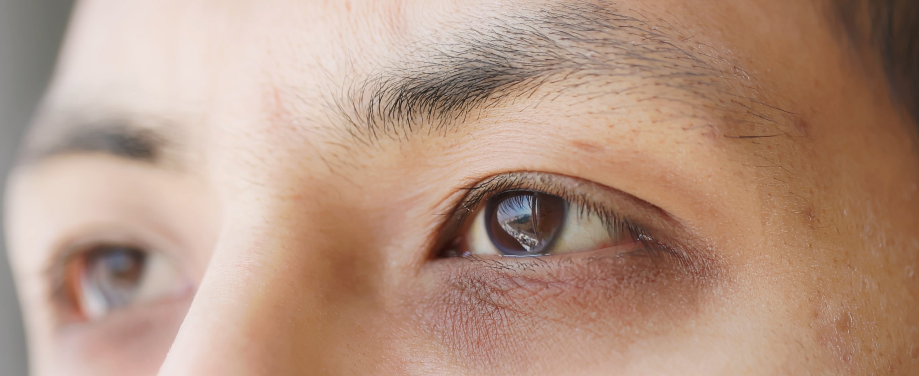 Puffiness vs. Dark Circles: What’s the Difference & How to Treat Both