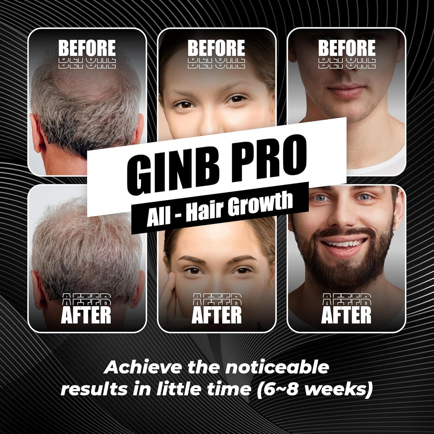 Abera Ginb Advanced Growth Beard & Eyebrows Serum For Men 0.67 fl Oz