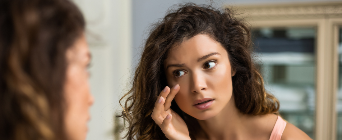 10 Easy Home Remedies to Treat Puffiness Naturally