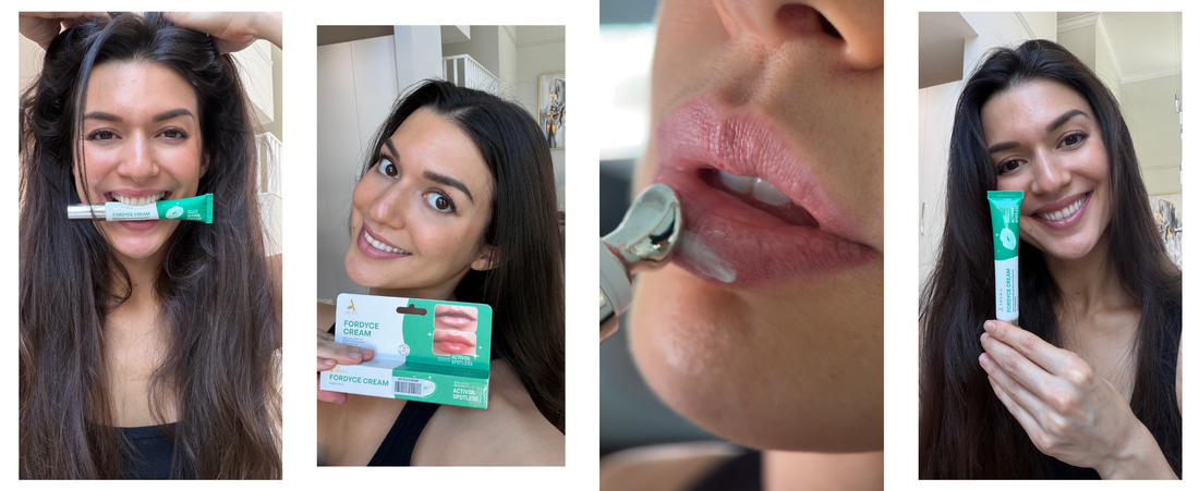 Fordyce Spots on Lips: What They Are & How to Improve Their Appearance
