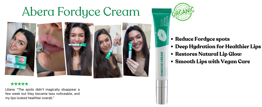 What Works Best for Fordyce Spots on Lips?