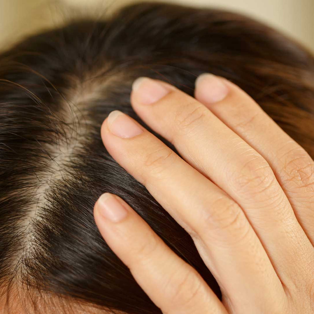 Understanding Dandruff: Symptoms, Causes, and Treatments – Abera.us