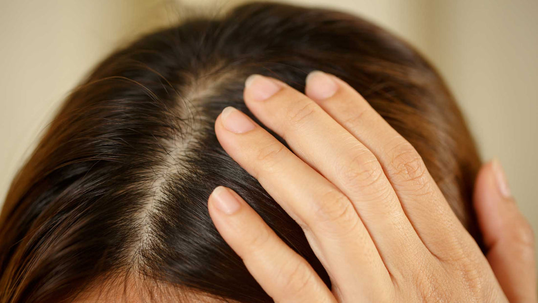 Understanding Dandruff Symptoms Causes And Treatments 9818