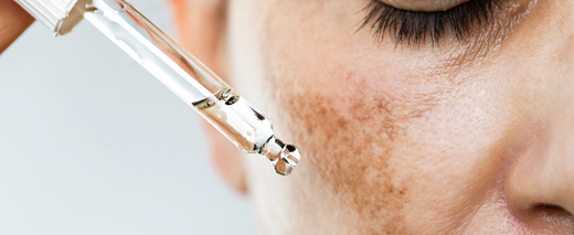 Discover the Ultimate Dark Spot Solution