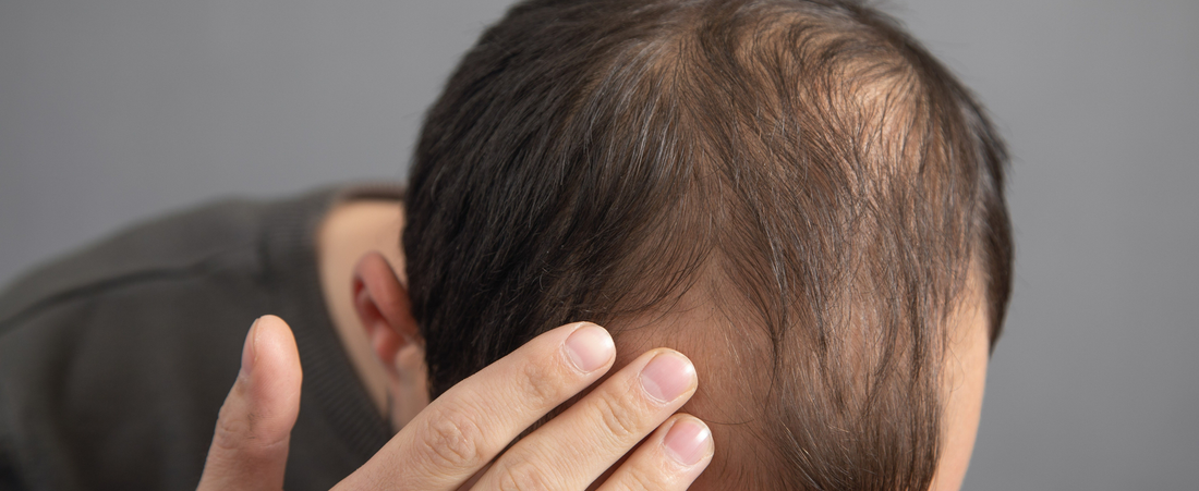 Top 5 Best Ingredients for Hair Growth Serum (That Actually Work)