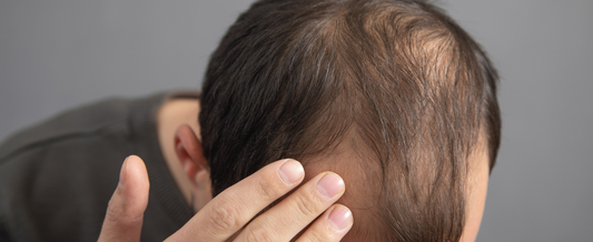 Top 5 Best Ingredients for Hair Growth Serum (That Actually Work)