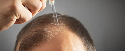 Do Hair Growth Serums Work? Real Results, Timeline & Benefits