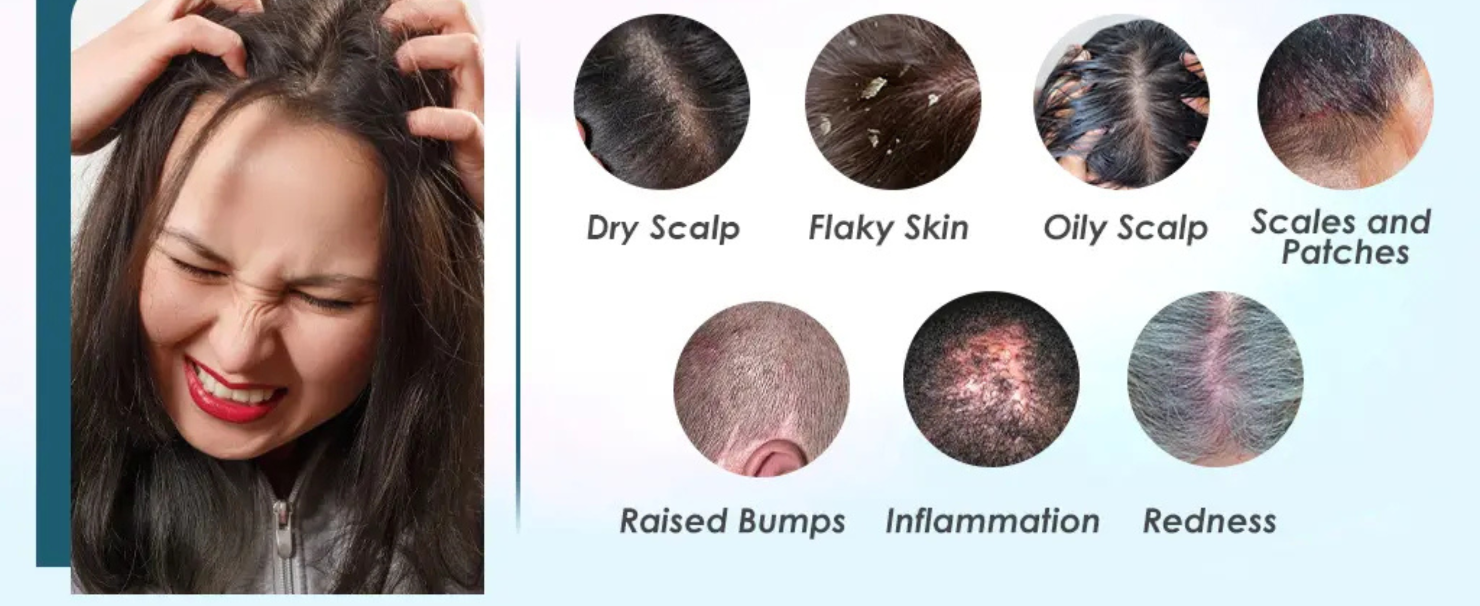 Best Shampoo for Itchy Scalp: How to Soothe Dryness, Oil and Irritation Natural