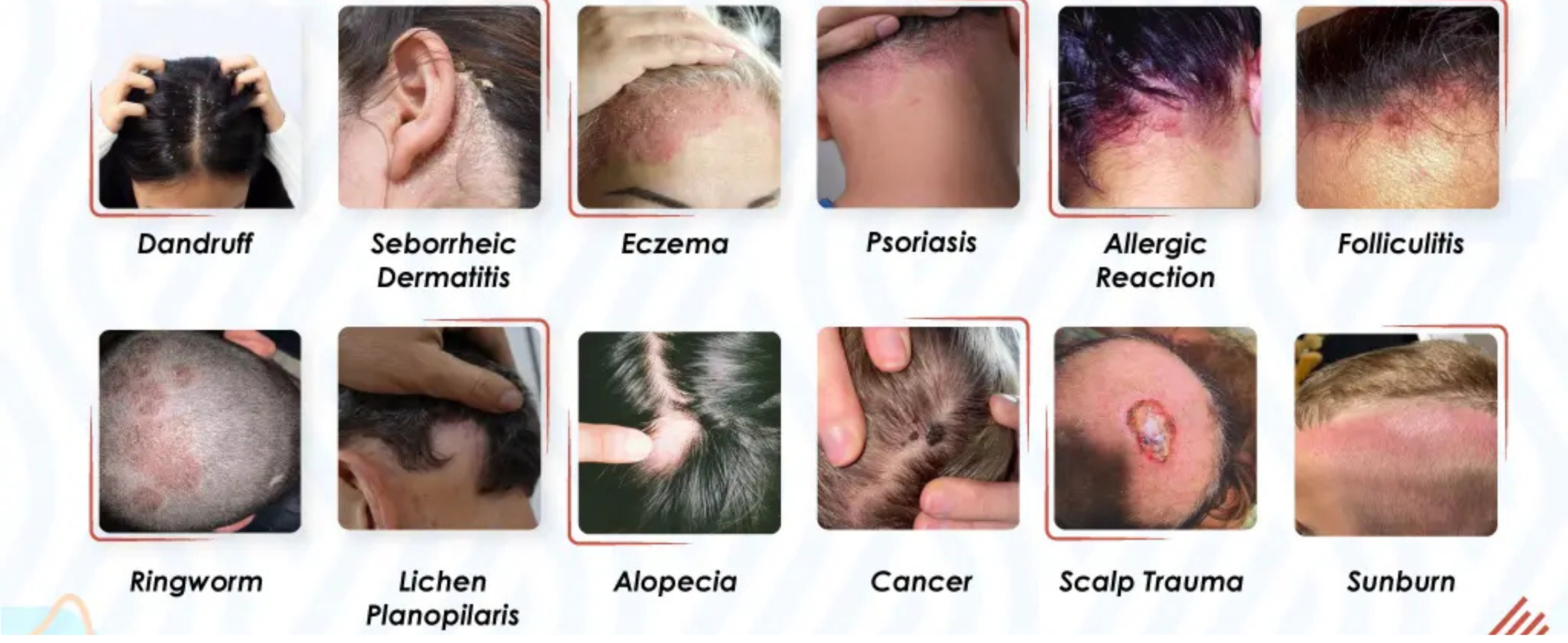 How to Stop Itchy Scalp Naturally: Simple Tips for a Healthier, Balanced Scalp