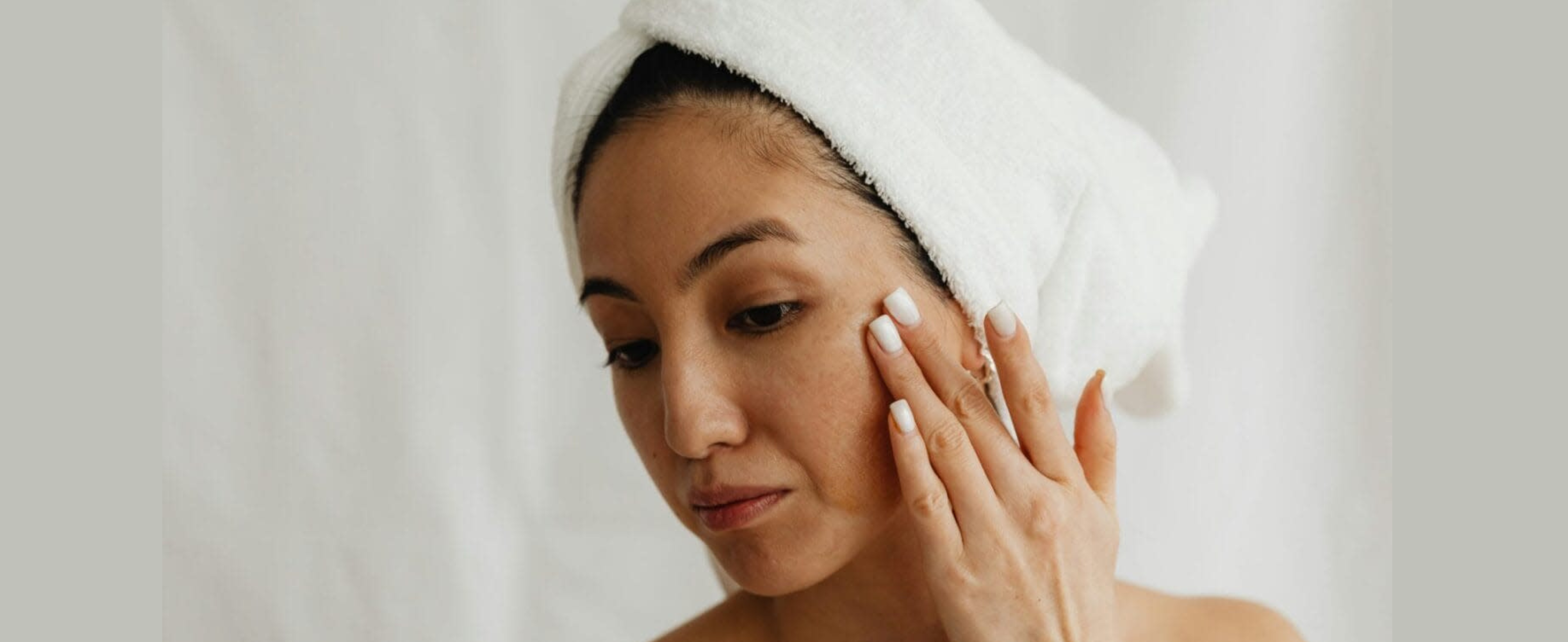 Why Your Melasma May Not Be Improving Even with Skincare