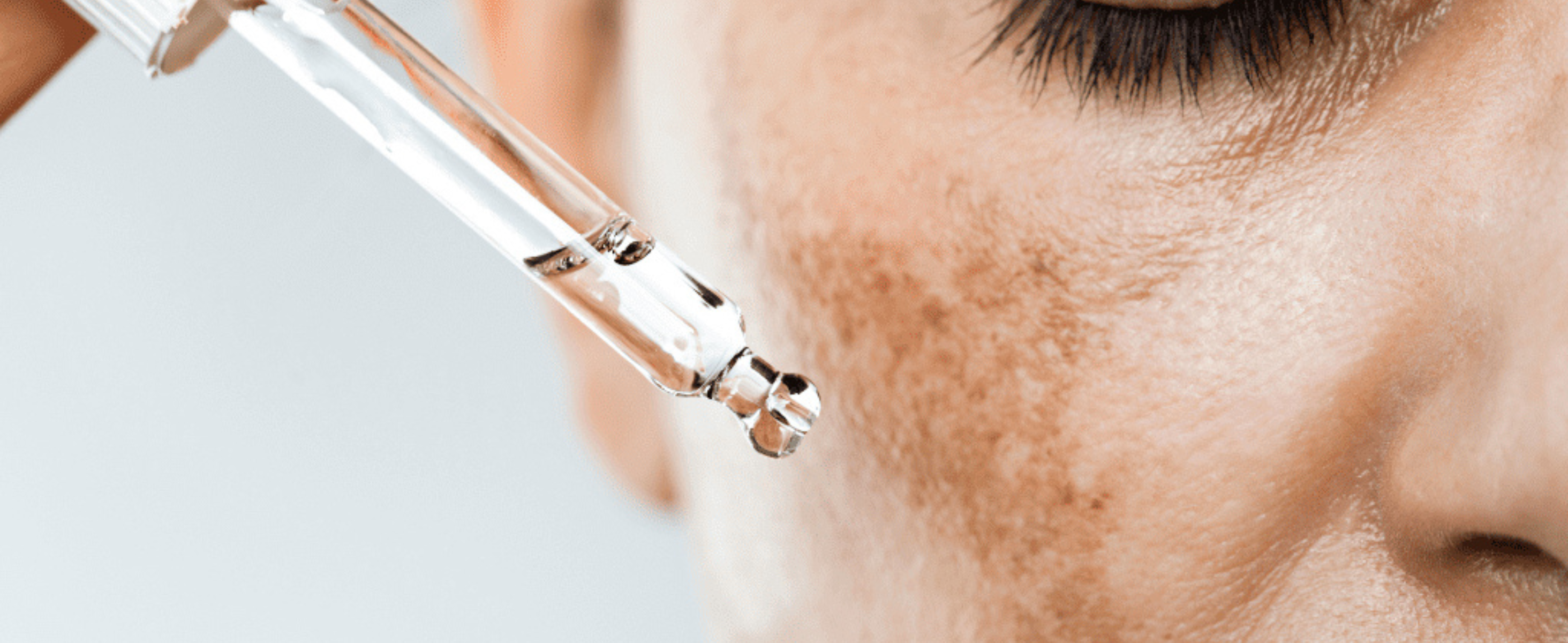 Best Ingredients for Melasma Treatment (That Actually Work)