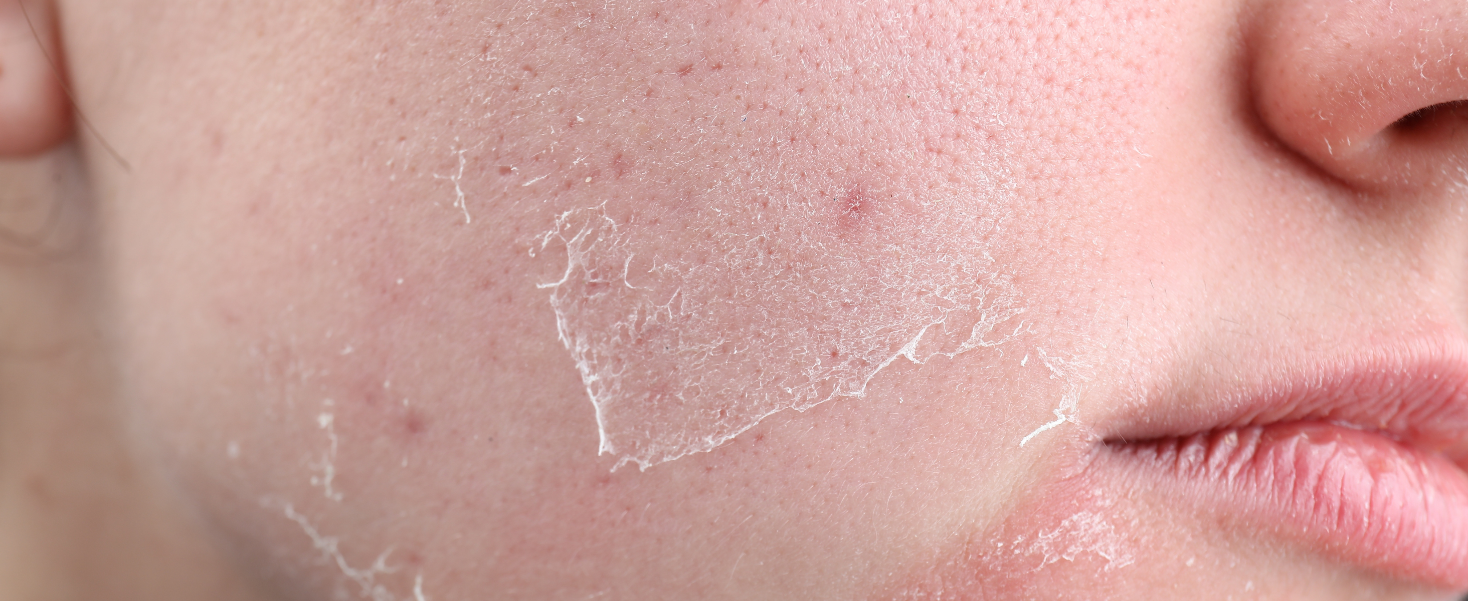 5 Habits That Making Your Skin Look Dull  — And How to Fix Them