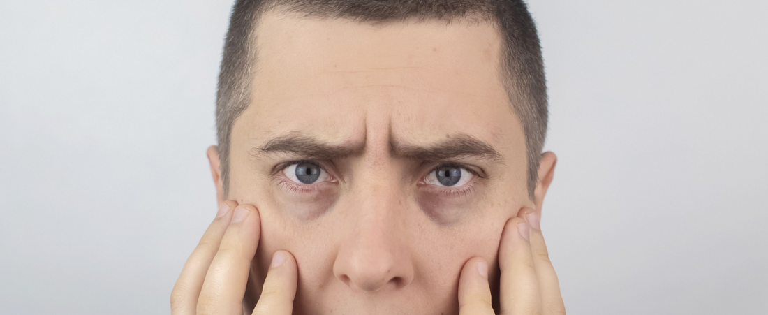 Men’s Skincare 101: Why You Shouldn’t Skip Eye Care