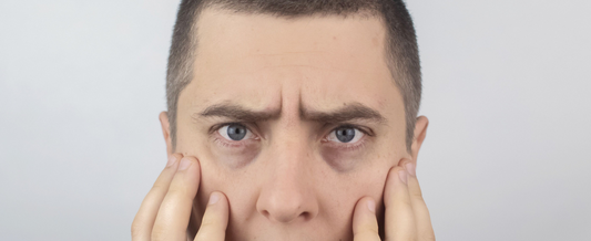 Men’s Skincare 101: Why You Shouldn’t Skip Eye Care