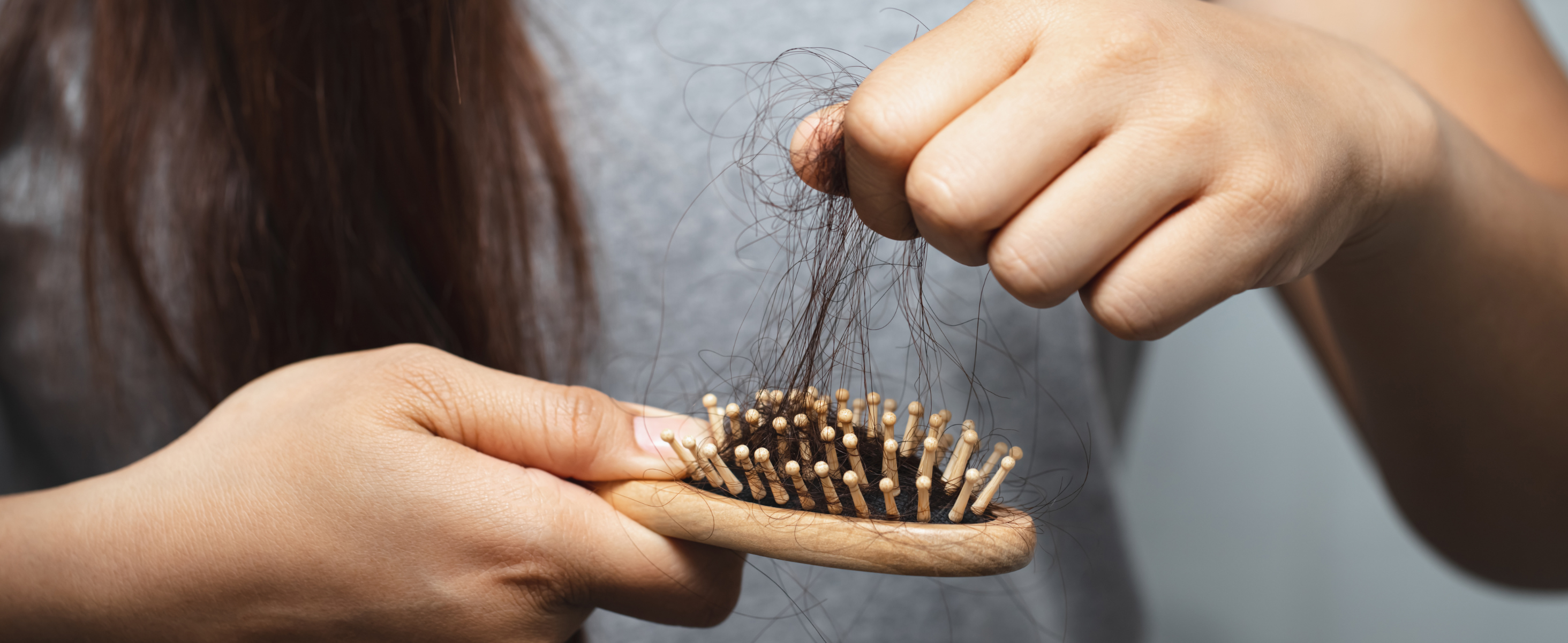 Stress & Hair Loss: How Anxiety Affects Your Scalp Health