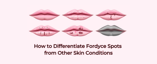 How to Differentiate Fordyce Spots from Other Skin Conditions