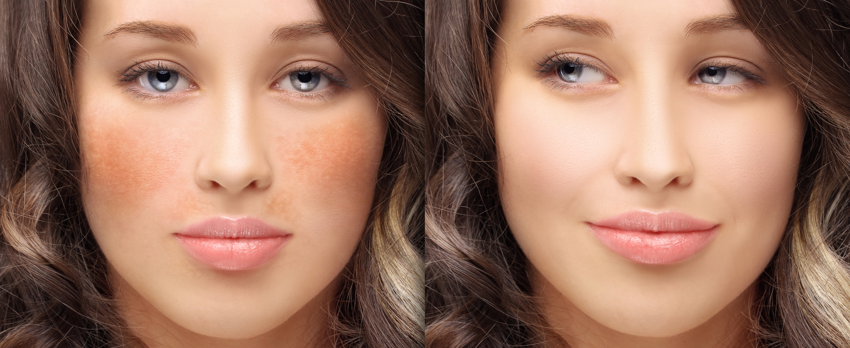 Top 5 Ingredients Dermatologists Recommend for Dark Spots & Melasma