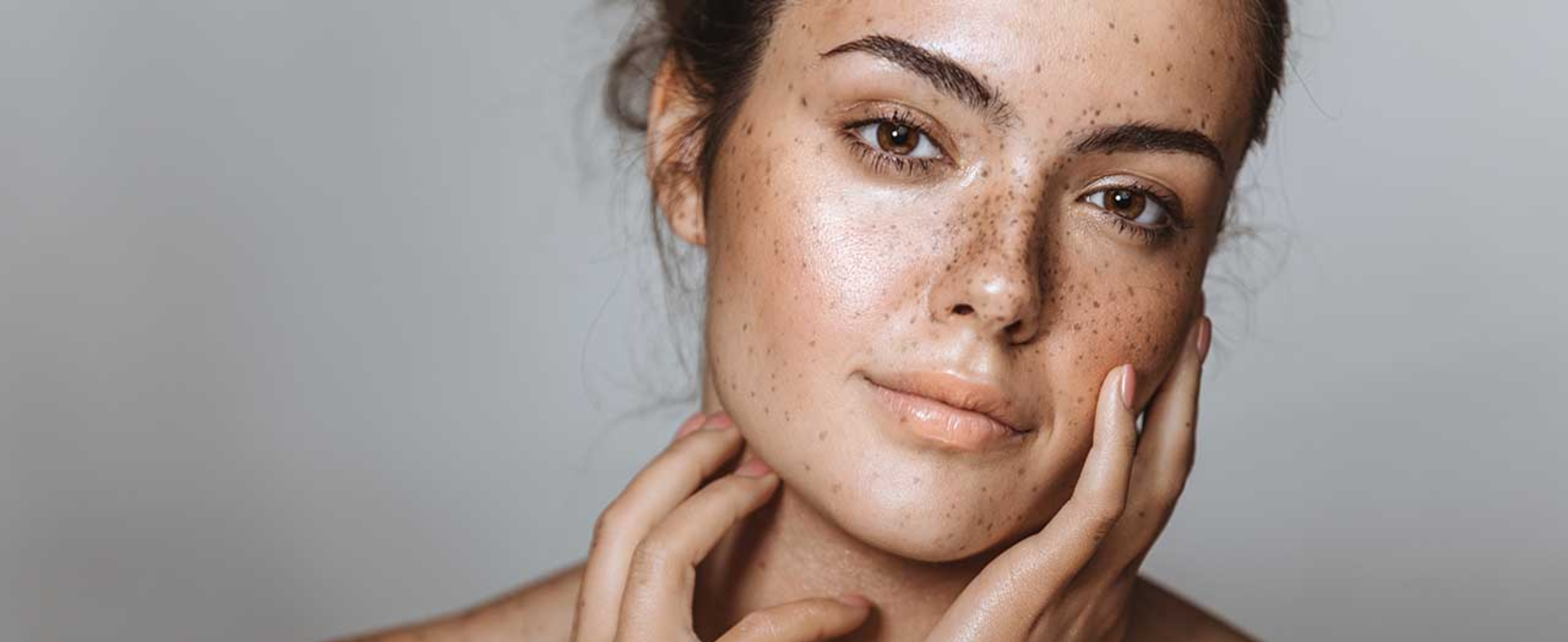 Daily Skincare Routine to Prevent and Treat Melasma