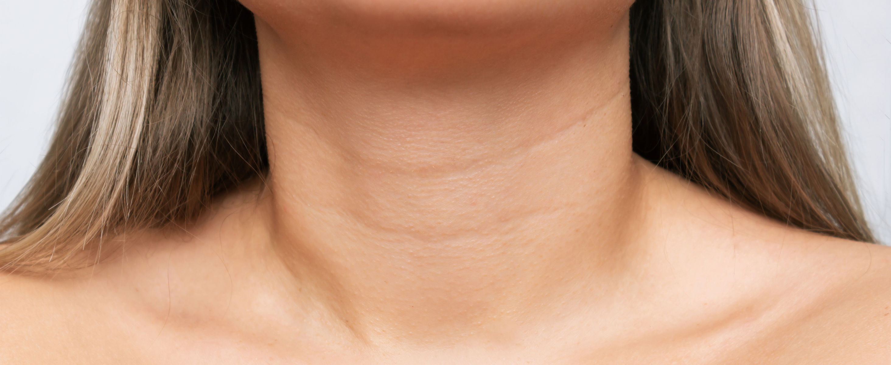 Neck Wrinkles? Here’s What Can Help