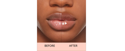 Find Your Perfect Lip Care Routine Based on Your Pigmentation
