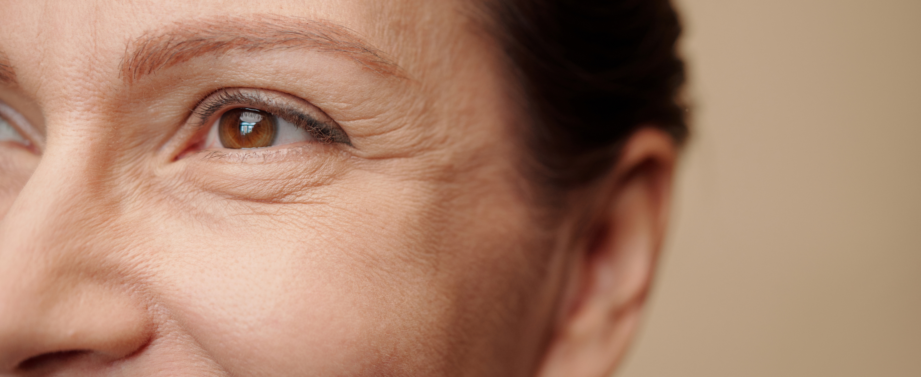 How To Get Rid Of Wrinkles Under Eyes