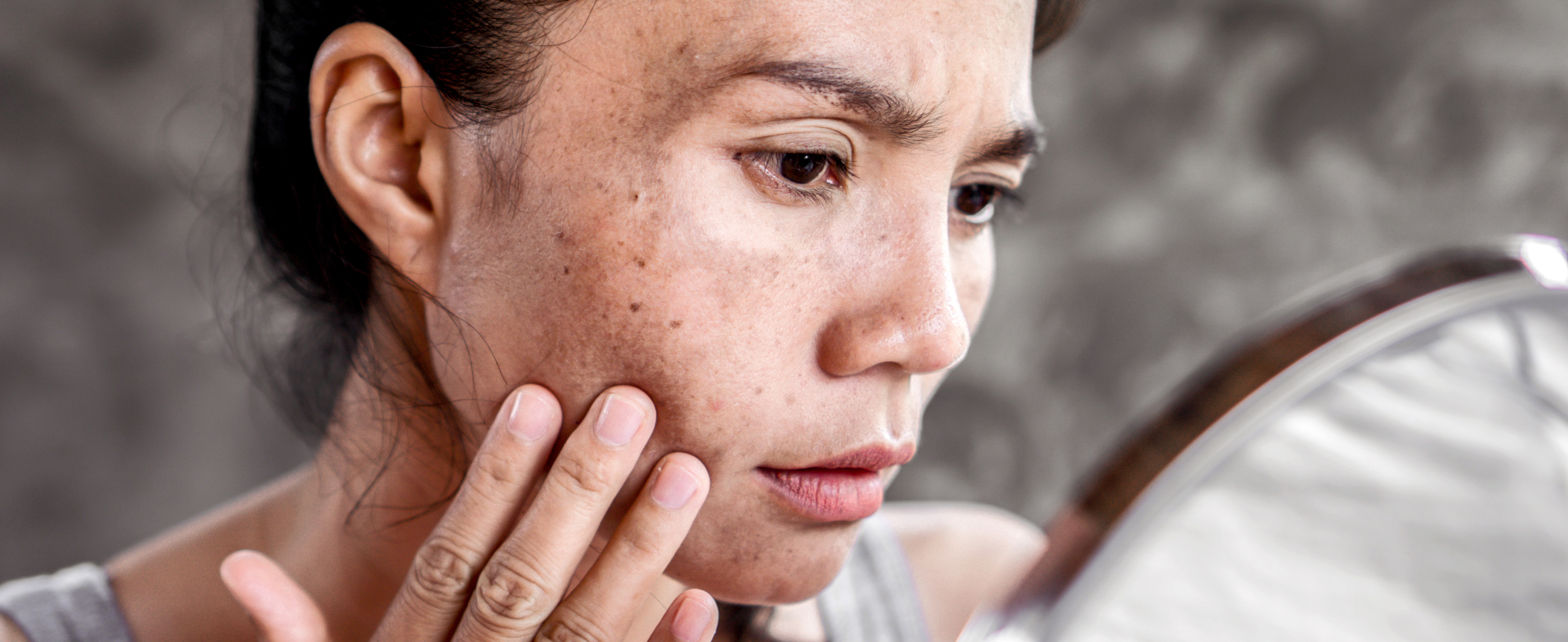 What Natural Ingredients Can Reduce Dark Spots and Even Skin Tone ...