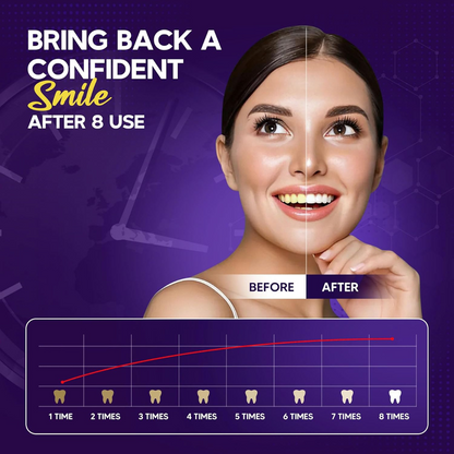 Abera Purple Teeth Whitening Foam | Instant Whitening & Colour Corrector  (5.07 Fl Oz)