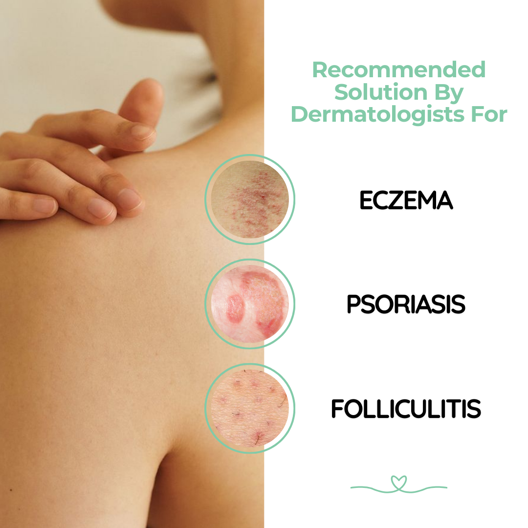 Atoskin Cream, Eczema Cream, Soothing Lotion for Psoriasis, Folliculitis (1.01 Oz)