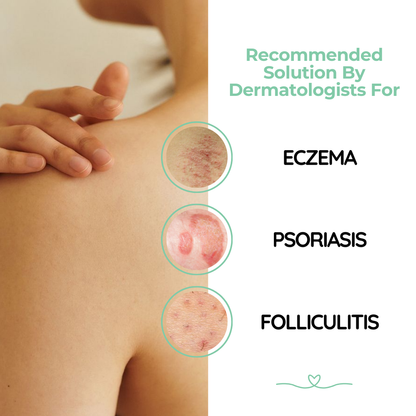 Atoskin Cream, Eczema Cream, Soothing Lotion for Psoriasis, Folliculitis (1.01 Oz)