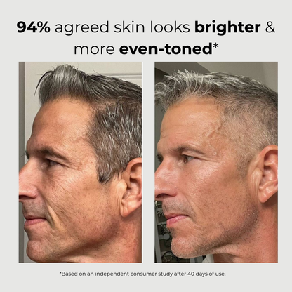 ABERA Men 6-in-1 Retinol Serum for Face 1.06 Fl Oz