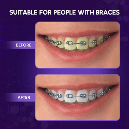 Abera Purple Teeth Whitening Foam | Instant Whitening & Colour Corrector  (5.07 Fl Oz)