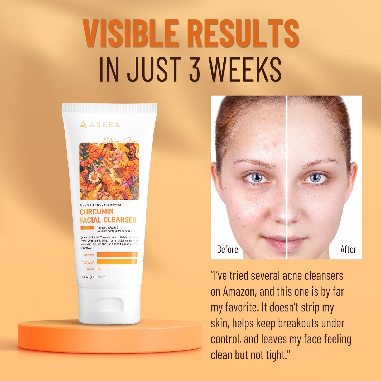 Abera Turmeric Face Wash for Acne-Prone & Sensitive Skin – 4-in-1 Curcumin Cleanser with Niacinamide, BHA & Centella – Gentle pH Balanced, Non-Comedogenic, Sulfate Free Facial Cleanser (3 BOXES)