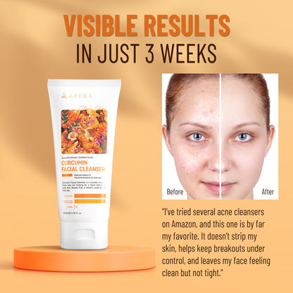 Abera Turmeric Face Wash for Acne-Prone & Sensitive Skin – 4-in-1 Curcumin Cleanser with Niacinamide, BHA & Centella – Gentle pH Balanced, Non-Comedogenic, Sulfate Free Facial Cleanser (3 BOXES)