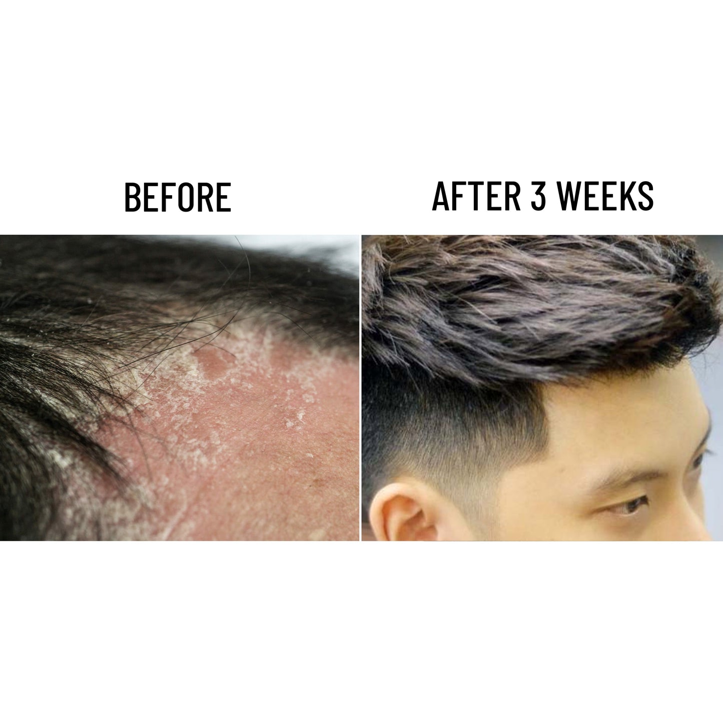 ABERA Amanda Shampoo