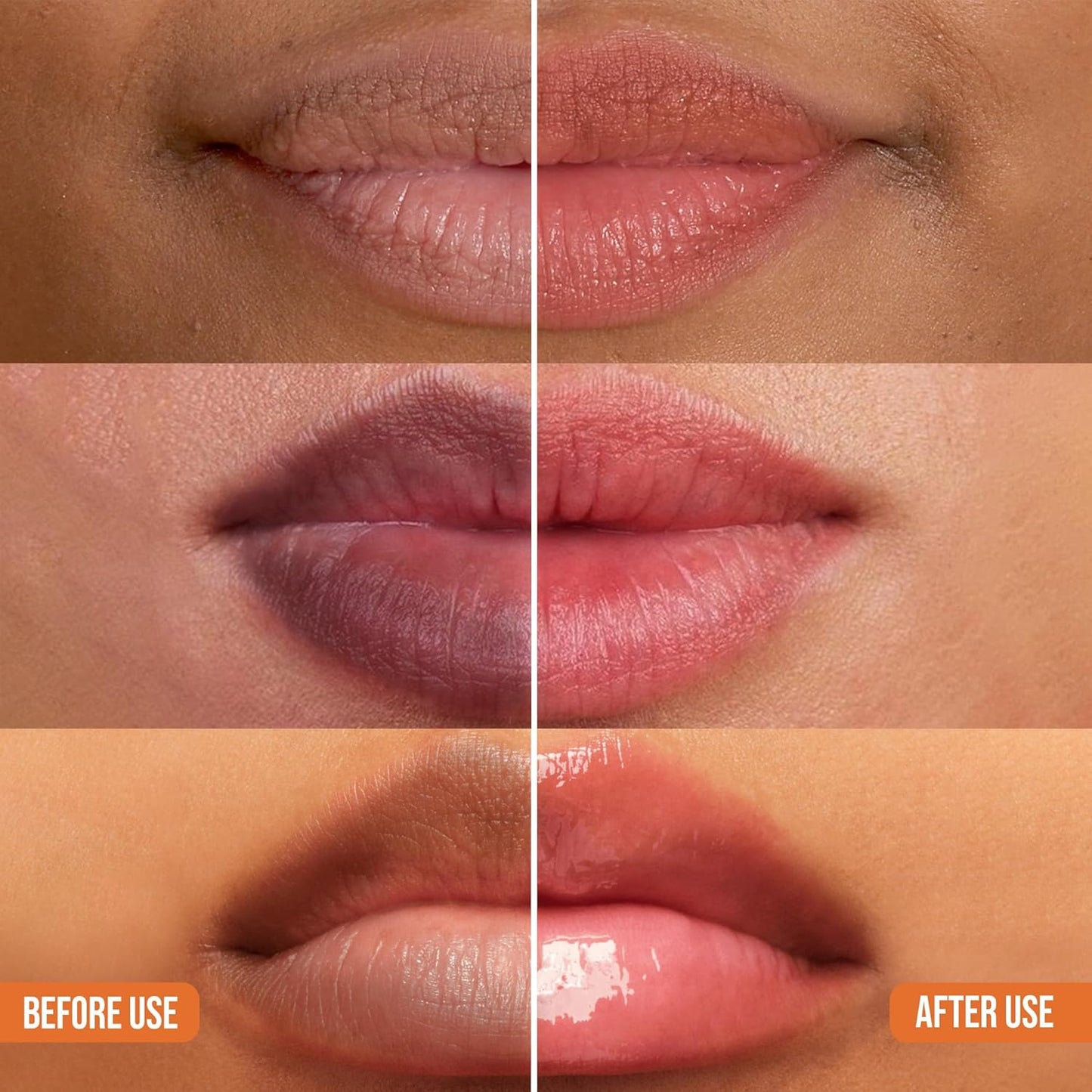 ABERA Dark Lips Corrector Cream - Moisturizing Lip Balm