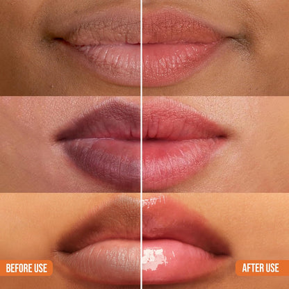 ABERA Dark Lips Corrector Cream - Moisturizing Lip Balm