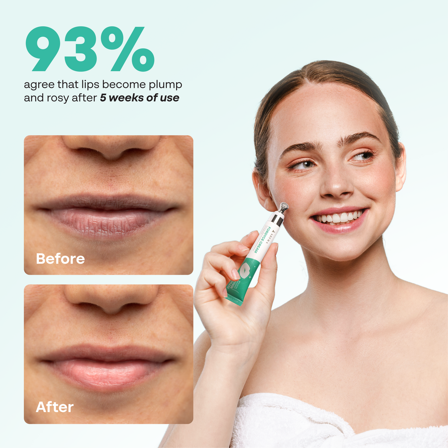 Abera Fordyce Cream For Lips – Hydrating & Healing Formula with Activoil Spotless