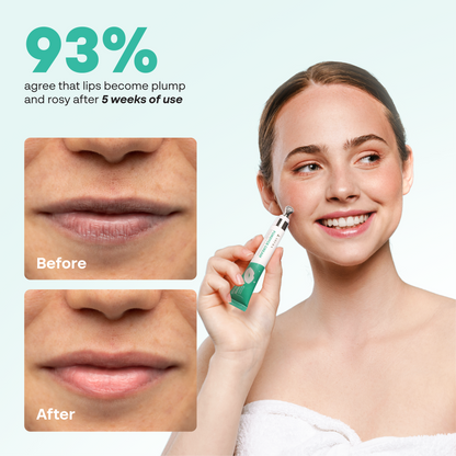 Abera Fordyce Cream For Lips – Hydrating & Healing Formula with Activoil Spotless