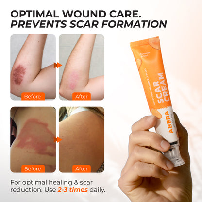 ABERA Red Turmeric Scar Removal Cream (Premium Version) 40ml