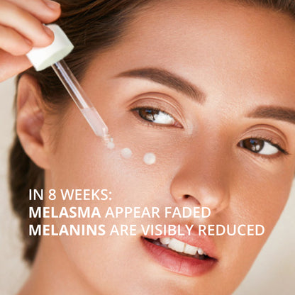 ABERA Melasma Serum Treatment 20ml
