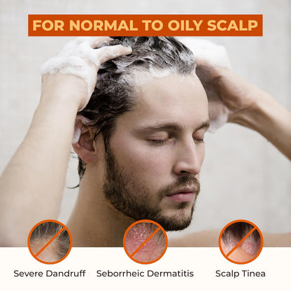 ABERA Anti-Dandruff Shampoo for Stronger Hair & Healthier Scalp